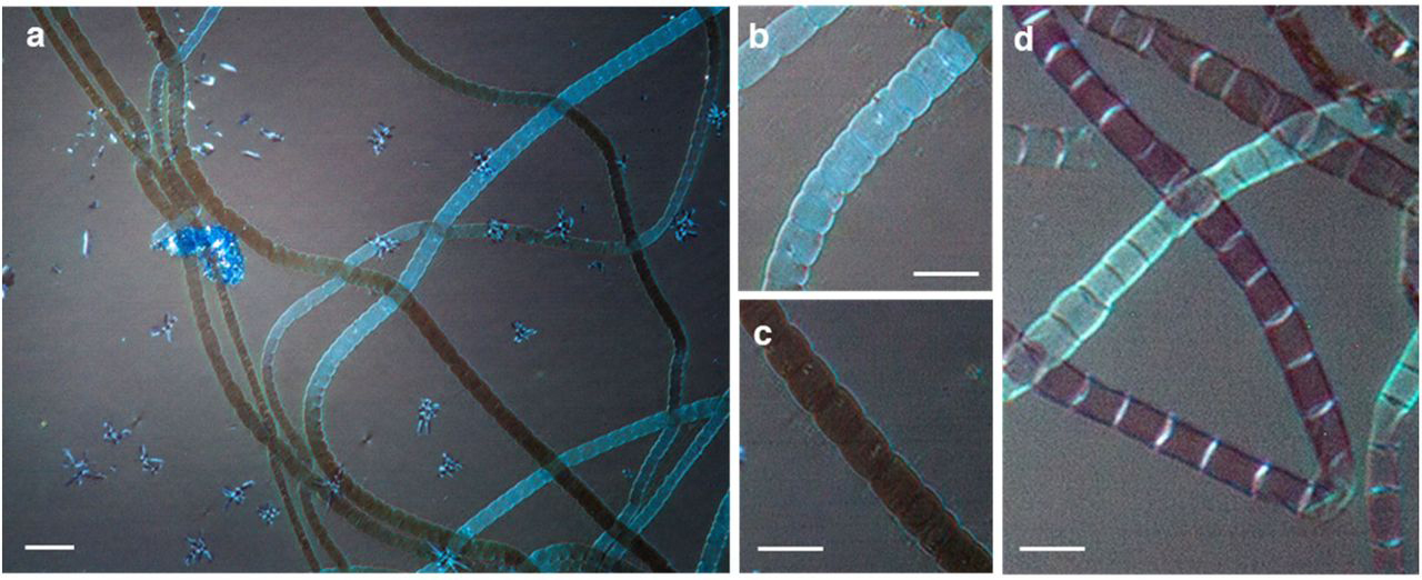 бактерии, провода, металл