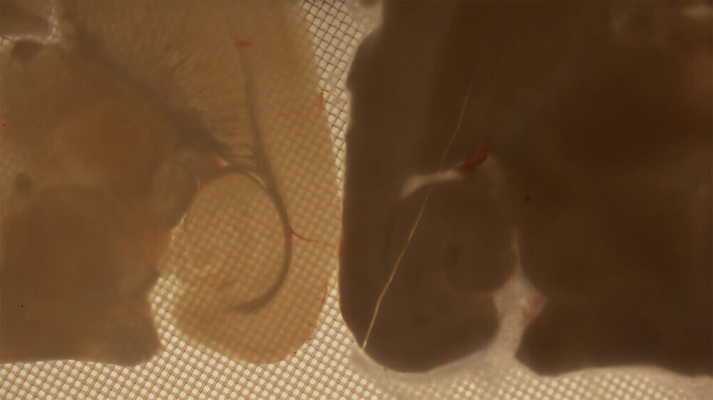 Клетки мозга после заморозки