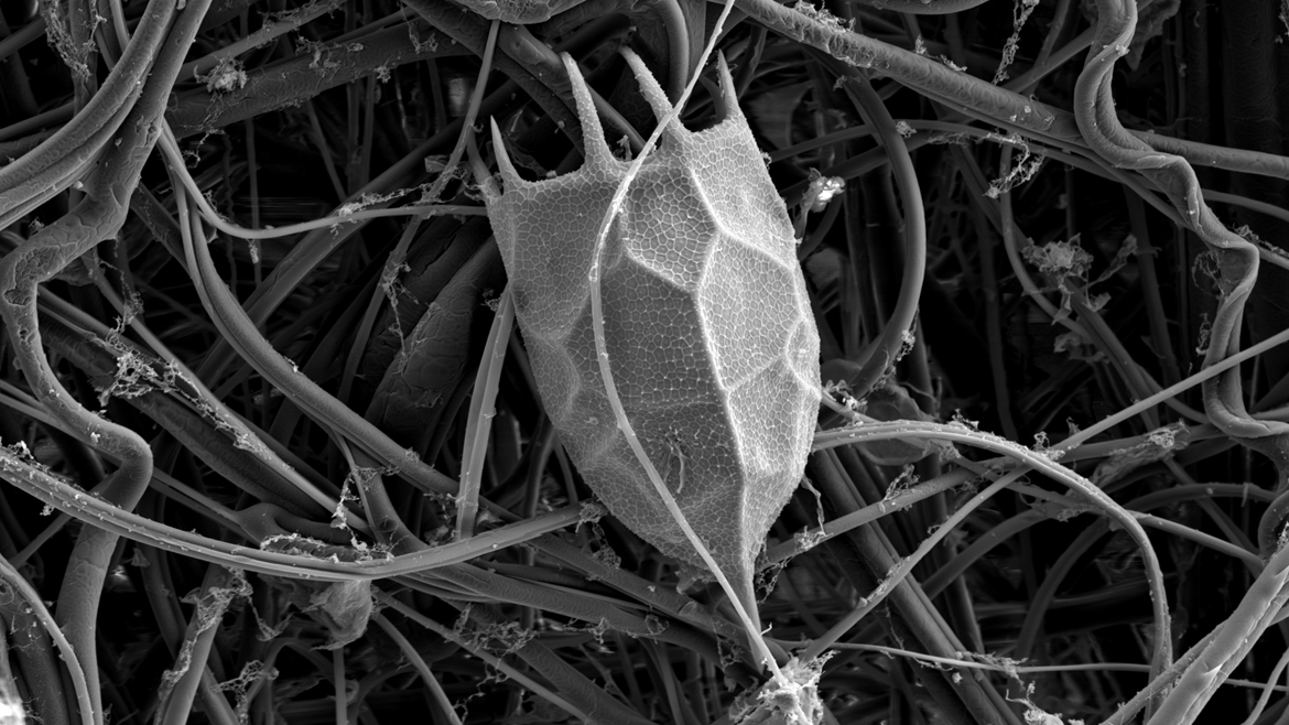 Локуль коловратки Keratella cochlearis, снимок электронного сканирующего микроскопа.