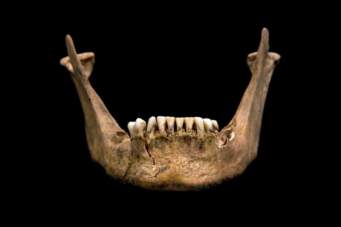 Зубы короля Ричарда III