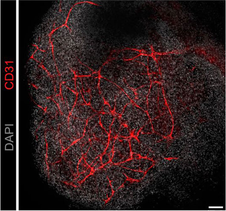 Ученые впервые вырастили в чашке кору мозга с сосудами