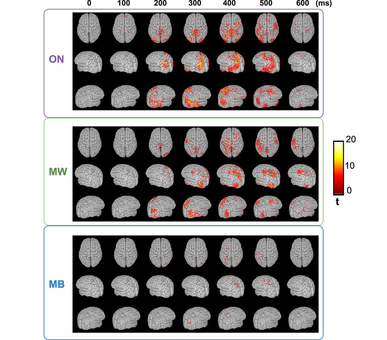 Что происходит с мозгом при остановке мыслей