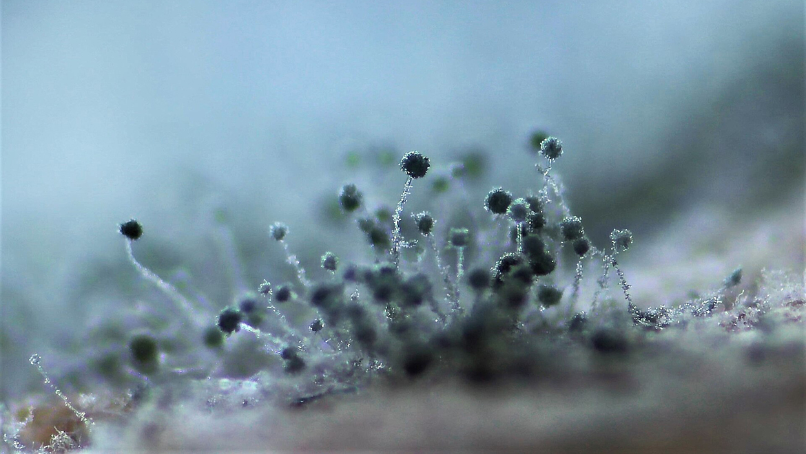 Фрагмент грибницы Mucor под микроскопом, увеличение 40×