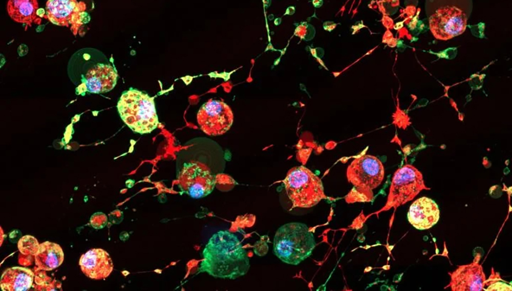  вирусы-перехватчики