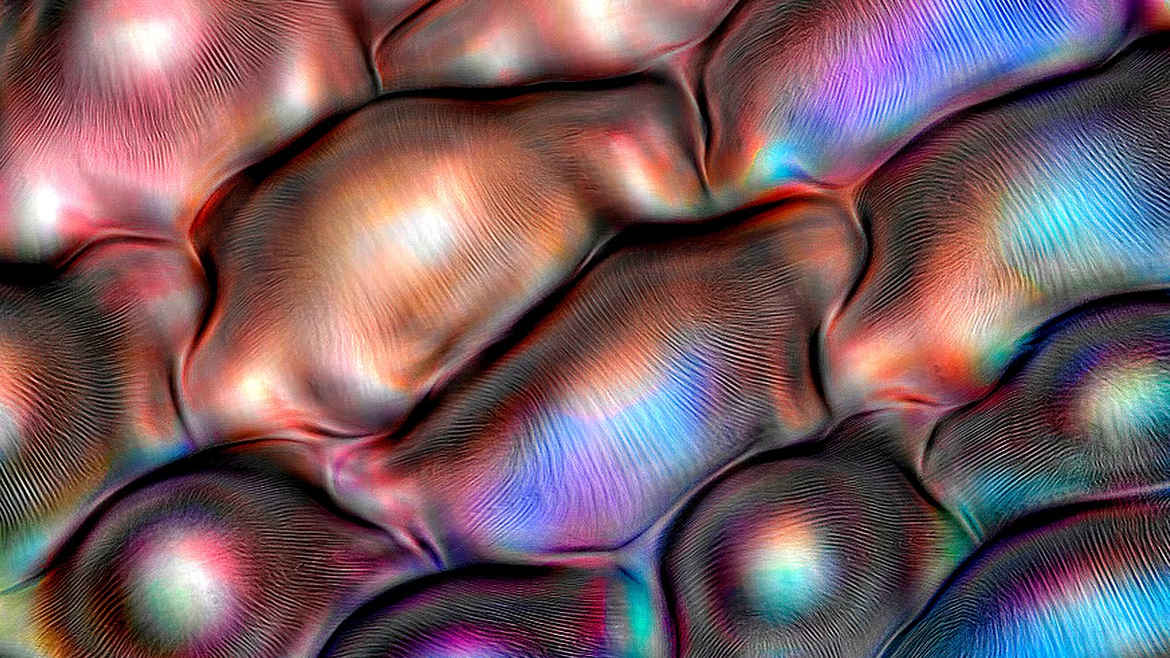 Клетки листа розы в электронном микроскопе
