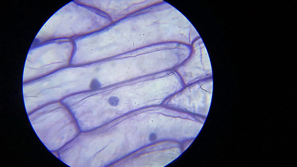 Лук под микроскопом 5 класс. Клетка шелухи лука под микроскопом. Кожица лука красного под микроскопом 10x. МИТОС лука под микроскопом. Клетка лука под микроскопом x10.