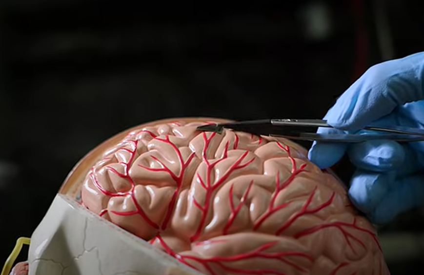 Микрочип, превращающий мозг в сверхскоростной интерфейс с компьютером