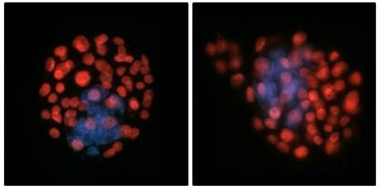 Сперматозоиды в космосе теряют ориентацию