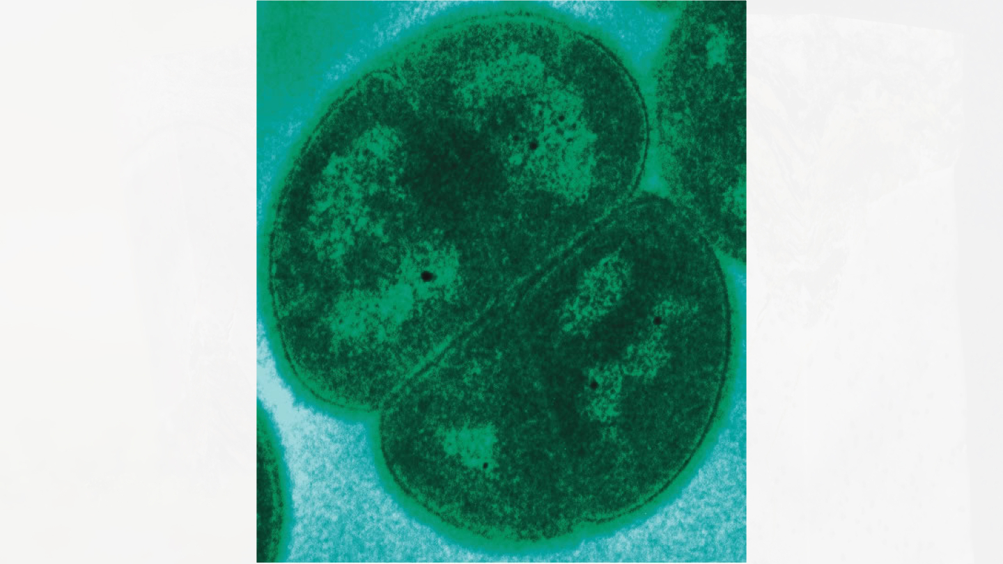 Deinococcus radiodurans