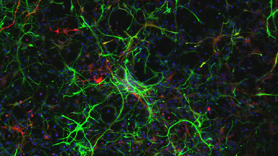 Культрура нервных стволовых клеток крысы (NSCs), маркированная антителами к белкам: GFAP, BIII-тубулин (отростки) и красителем DAPI (ядра).
