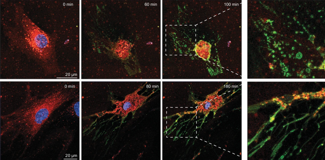 умирающие клетки