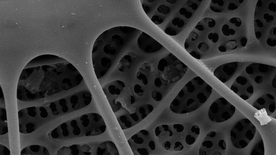 Modern diatoms under SEM 7