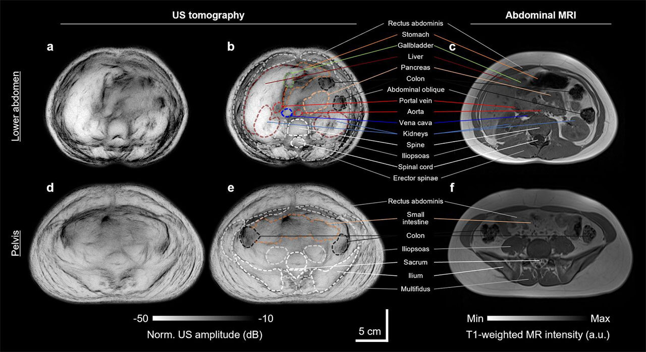 Ультразвуковая томография тела