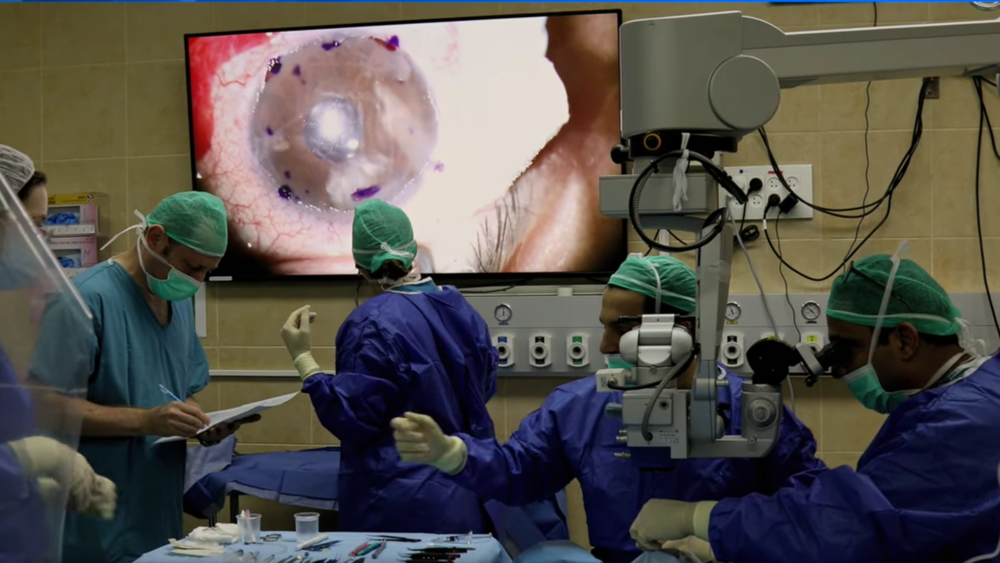 Операция на глазе с использованием 3D-роговицы