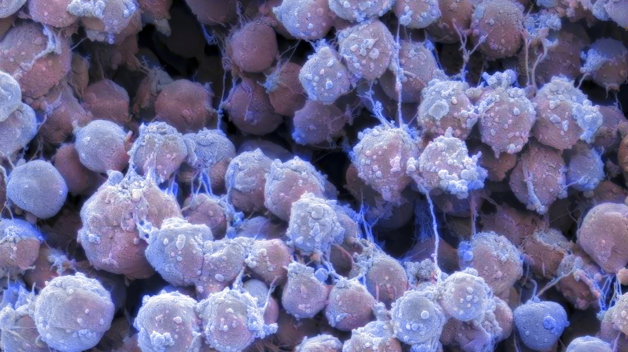 Метан, археи