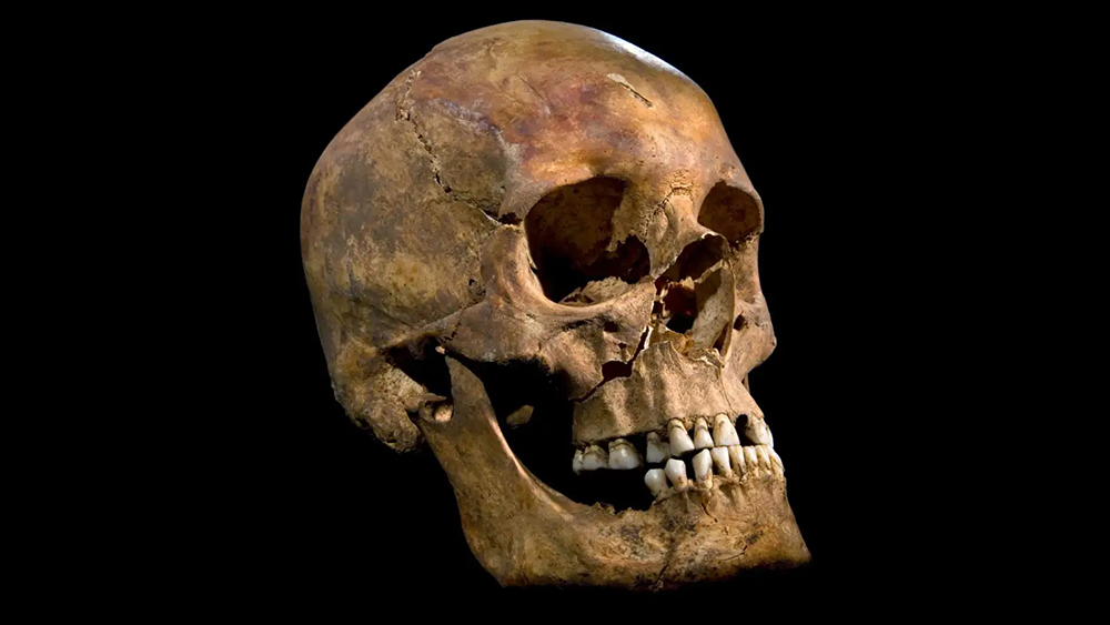 Ричард 3, зубы