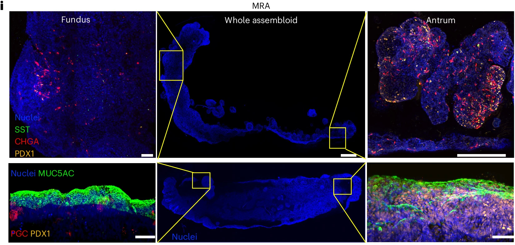 Первый полноценный мини-желудок