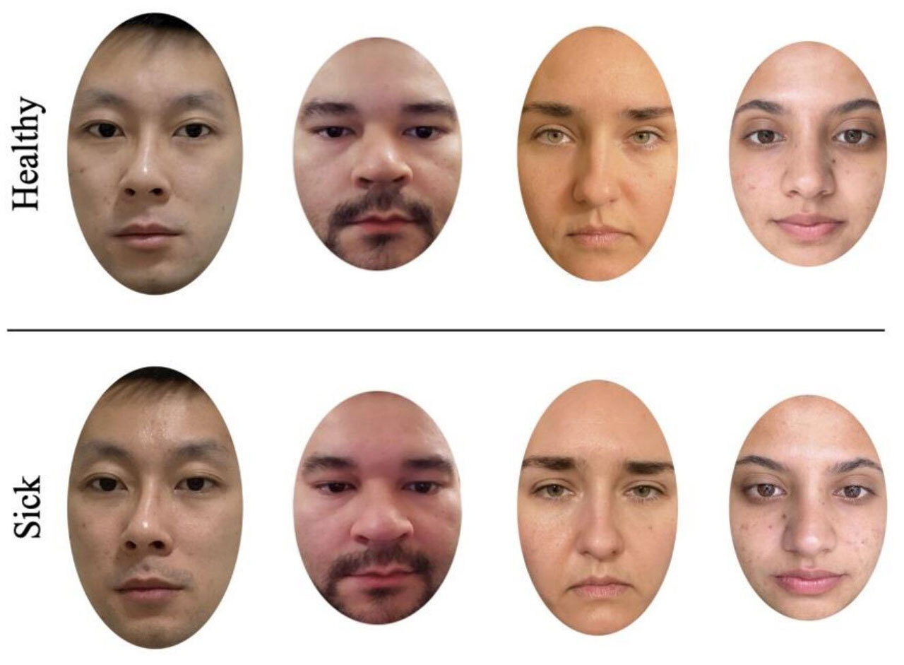 Болезнь по лицу