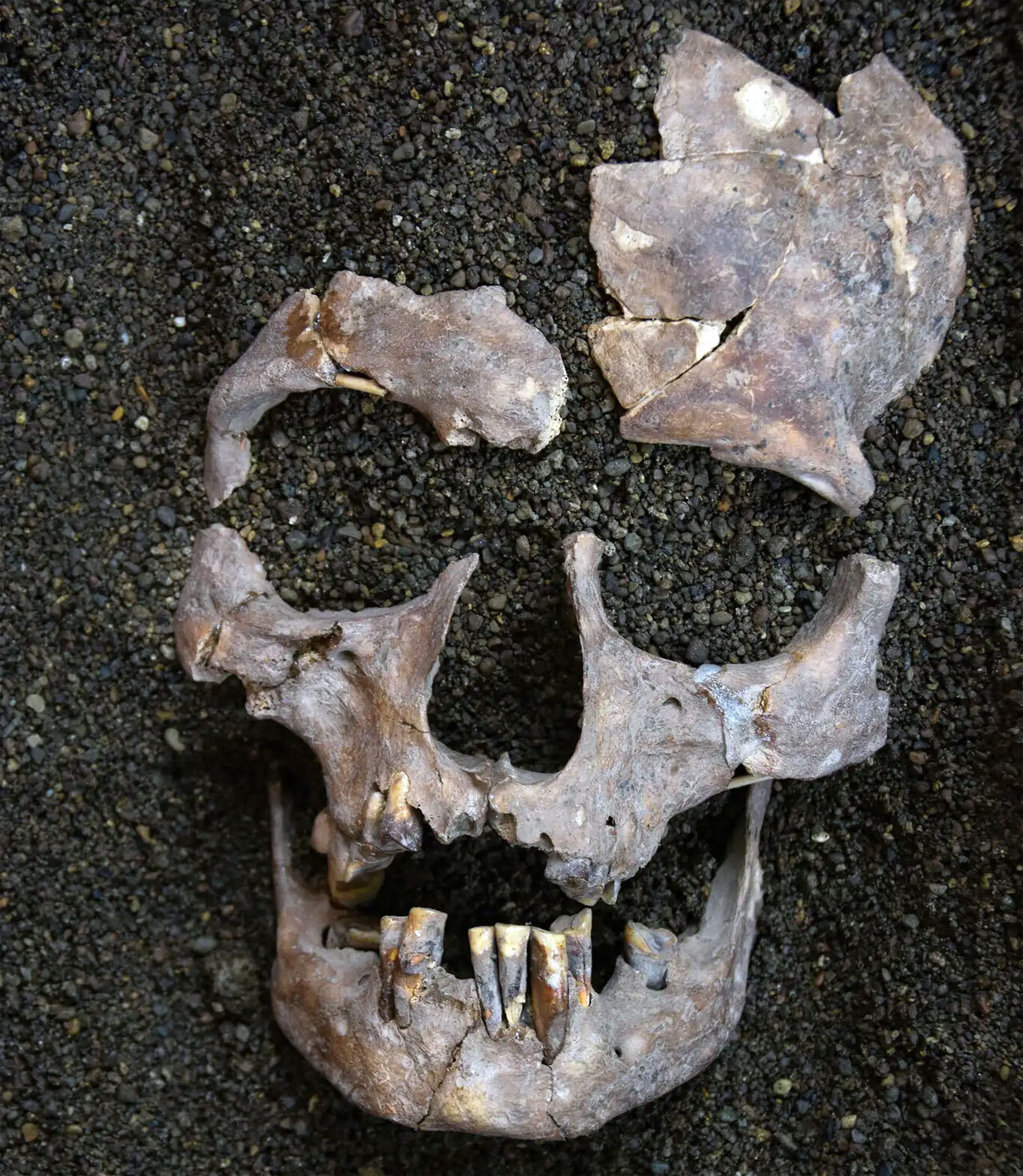 В зубах возрастом 25 000 лет нашли древнейшие свидетельства употребления психоактивных веществ
