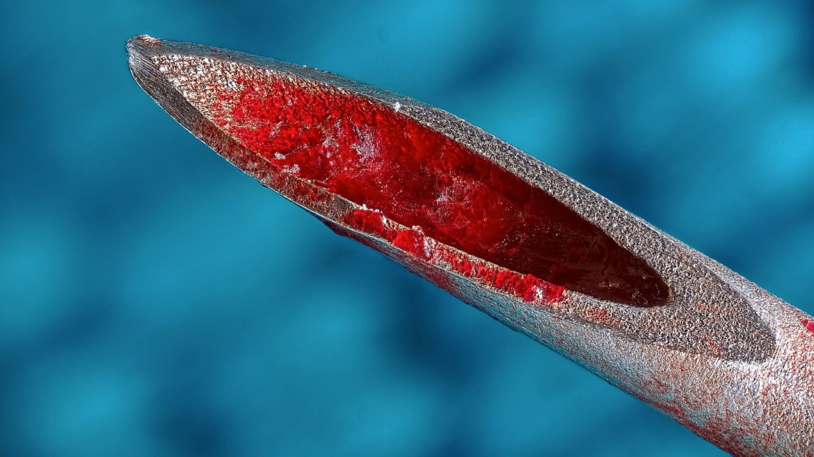 Кровь на игле шприца под микроскопом
