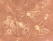 Юлия-Даная Бойченко - Меланома B16-F10 (15 ± 1.5 мкм)