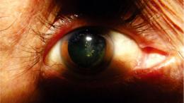 Глаза , как новогодняя елка