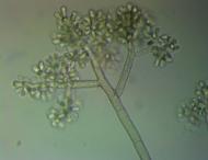 Lilia Luzhkova - другая сторона разрушения: конидиеносцы Botrytis cinerea Pers.