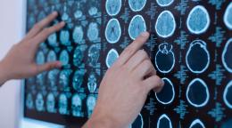 Ученым удалось повлиять на поведение человека, облучив его голову ультразвуком