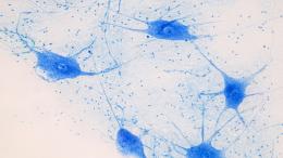 нервные клетки, нейроны