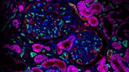 Образец почки ГМ-свиньи: цвет фуксия — человеческий белок CD46; зеленый — эндотелиальные клетки почек; синий — ядра