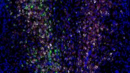 Экспрессия различных генов и белков (белый, красный и зеленый) в нейронах клеток мозга мыши (синий).