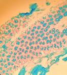 Юлия-Даная Бойченко - Срез кишечных ворсинок