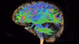 Развитие и старение мозга