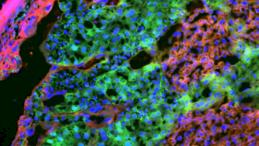 Сигнальные клетки (выделены зеленым цветом) плаценты мыши, которые играют ключевую роль в дистанционном управлении метаболизмом матери для обеспечения снабжения питательными веществами и роста плода