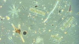 Вид через микроскоп на разнообразное сообщество микроводорослей пресноводного озера