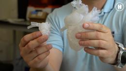 Он продлевает вам жизнь: биоинженер о клапанах в сердце