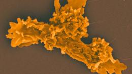 Амеба I. cascadensis 