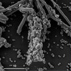 александр семёнов - Микробные ассоцианты влияют на морфогенез патогенного гриба Candida albicans (Microbial associates affect the morphogenesis of the pathogenic Candida albicans)