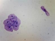 Ирина Ильина - Буккальный эпителий