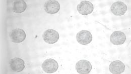 Впервые выращена структура, похожая на ранний эмбрион, из стволовых клеток 