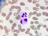 Никита Герасин - Клетки крови