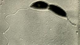 Бактерия Caulobacter делится, образуя стебельчатую клетку (справа) и роевую клетку со жгутиком