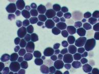 Артём Абрамов - Грибы рода Candida в препарате, окрашенном по Грамупри росте колонии 120 часов