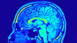 МРТ показала, как работает мозг чемпиона США по запоминанию