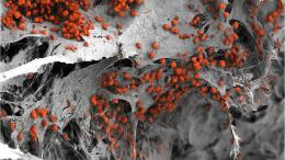 ткани созданного костного мозга под электронным микроскопом